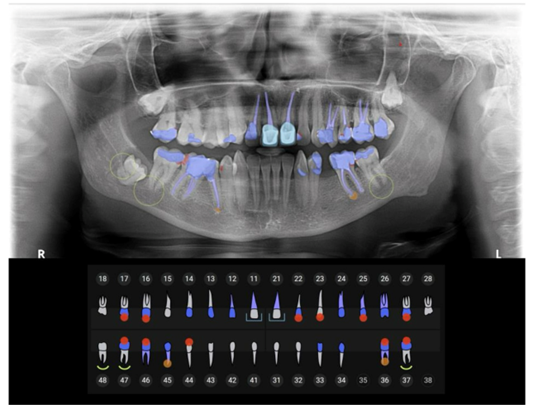 AI in Dental Practice