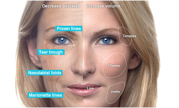 Relive your 20s with Allergan Botox & Careprost – How?