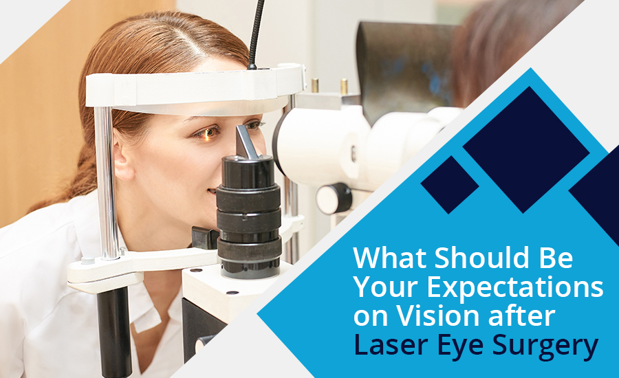 What Should Be Your Expectations on Vision after Laser Eye Surgery