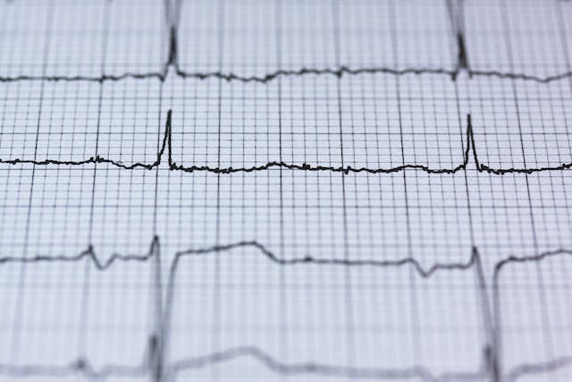 How Cardiac Arrest is Different From Heart Attacks?