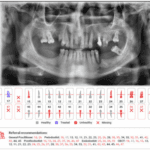 AI in Dentistry