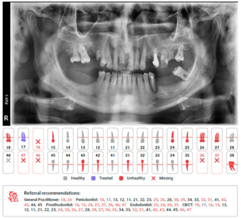 AI in Dentistry